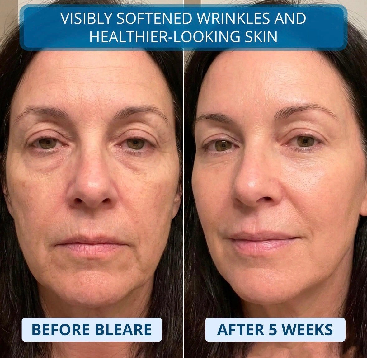 Collagen Boost