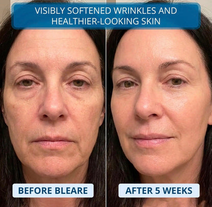 Collagen Boost