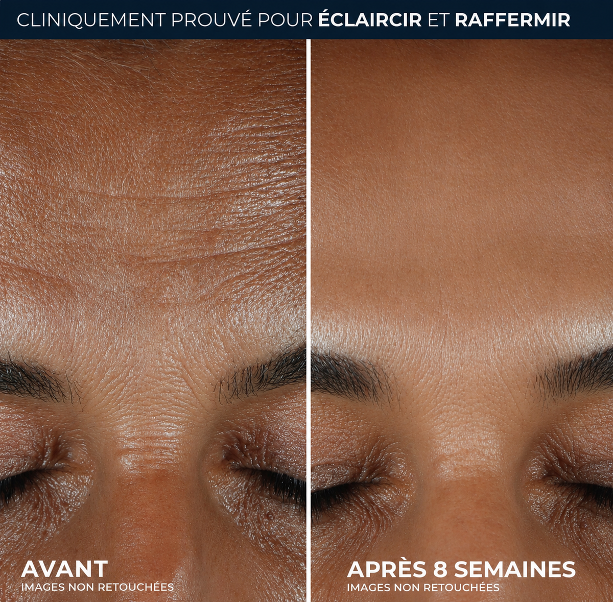5x Vitamin C Face Cream