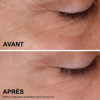 Sérum concentré double action